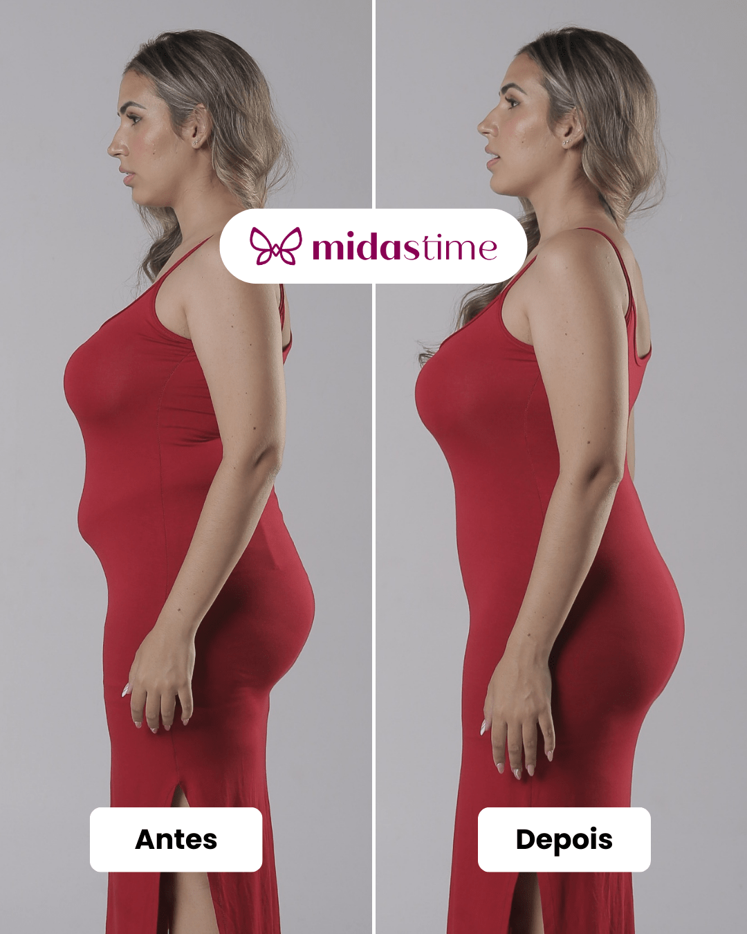 Up Shaper - Bermuda Modeladora Que Não Enrola - Troca - Midastime