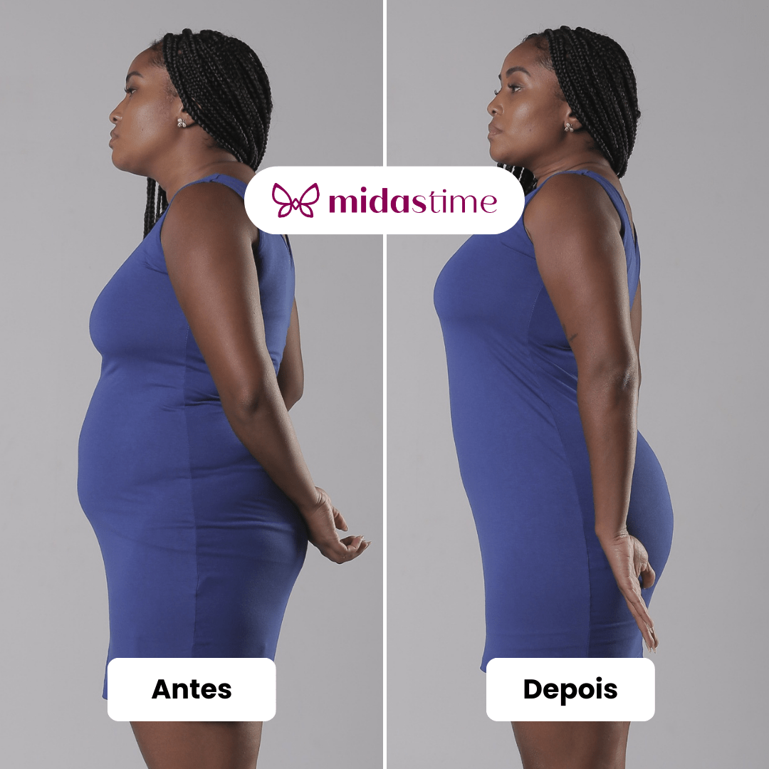 2 Up Shapers - QUEIMA DE ESTOQUE - Compre 1 Leve 2 - Midastime