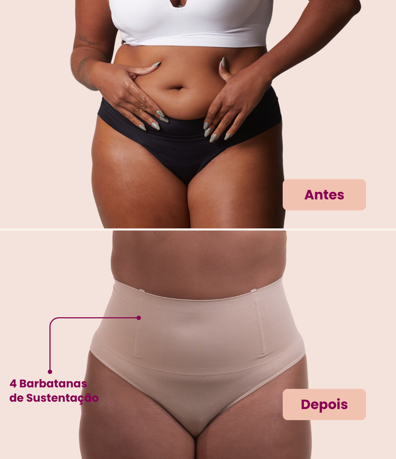 Antes e depois: Calcinha Hope: barriga lisa com as 4 barbatanas