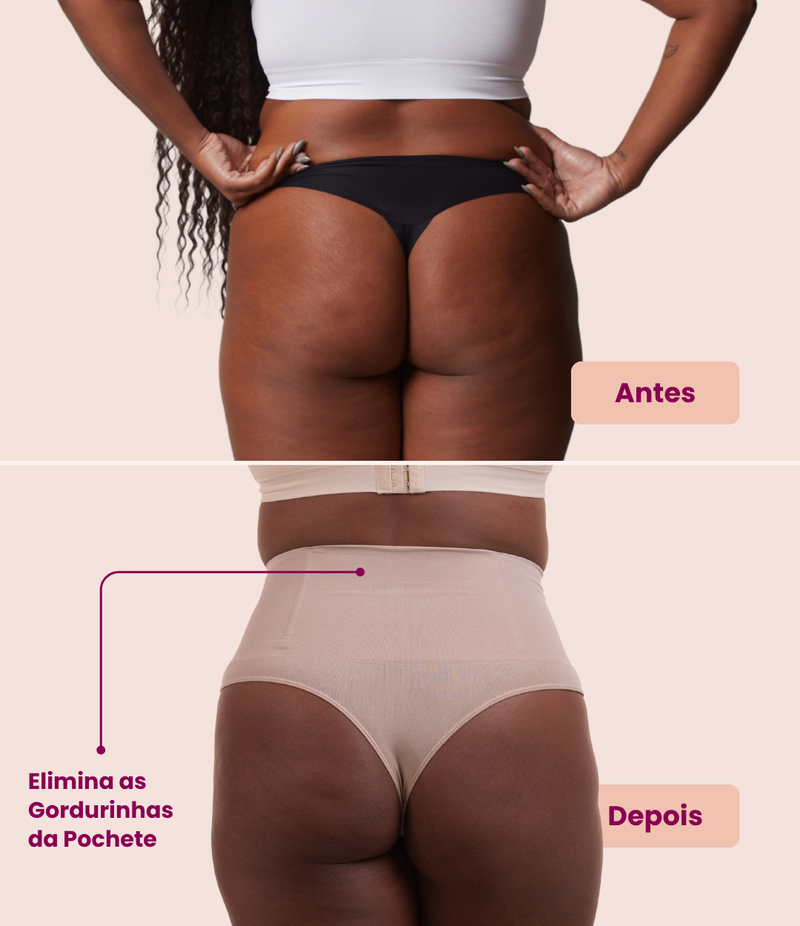 Antes e depois: Calcinha Hope: sem as gordurinhas da pochete